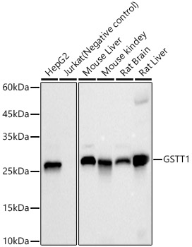 GSTT1 Rabbit mAb