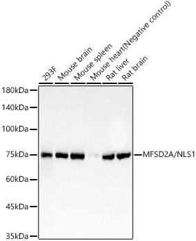 MFSD2A/NLS1 Rabbit mAb