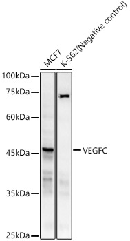 VEGFC Rabbit mAb