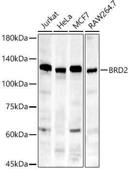 [KD Validated] BRD2 Rabbit mAb