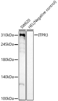 ITPR3 Rabbit mAb