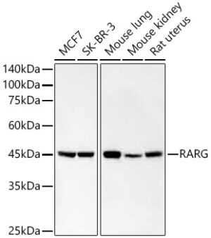 RARG Rabbit mAb