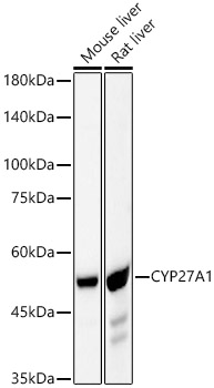 CYP27A1 Rabbit mAb