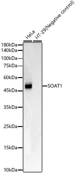 SOAT1 Rabbit mAb