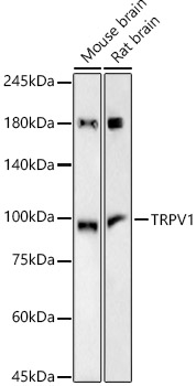 TRPV1 Rabbit mAb