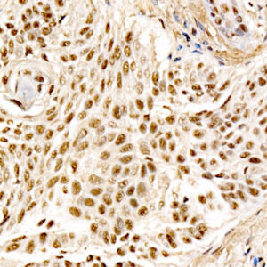 MDM2 Rabbit mAb