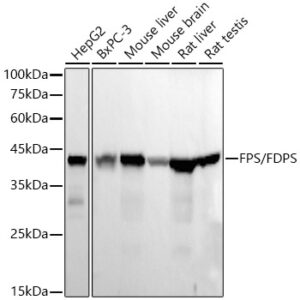 FPS/FDPS Rabbit mAb