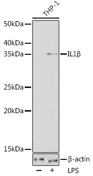 IL1β Rabbit mAb