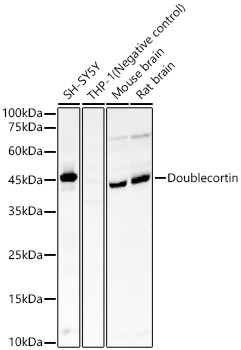 Doublecortin Rabbit mAb