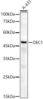 [KD Validated] DEC1 Rabbit mAb