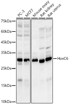 HoxC6 Rabbit mAb