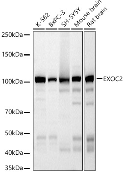 EXOC2 Rabbit mAb