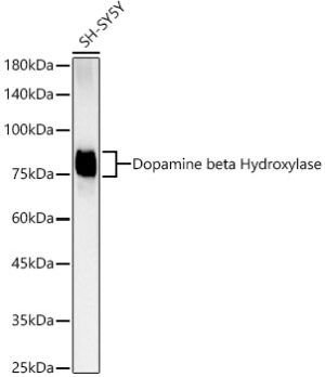 Dopamine beta Hydroxylase Rabbit mAb
