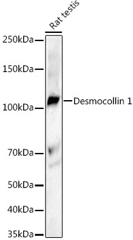 Desmocollin 1 Rabbit mAb