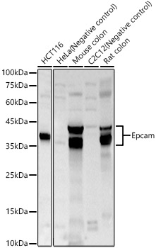 Epcam Rabbit pAb