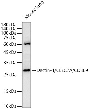 Dectin-1/CLEC7A/CD369 Rabbit pAb