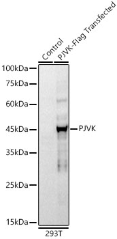 PJVK Rabbit mAb