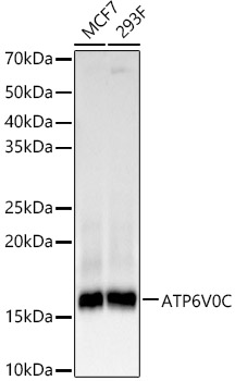 ATP6V0C Rabbit mAb