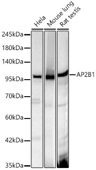 AP2B1 Rabbit mAb