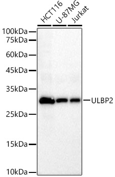 ULBP2 Rabbit mAb