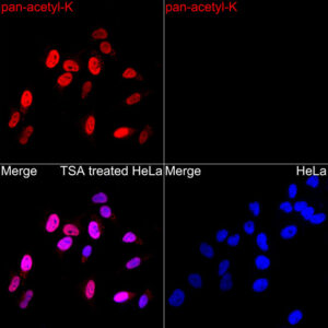 Pan Acetyl-Lysine Rabbit pAb