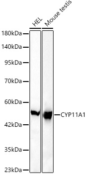 CYP11A1 Rabbit mAb