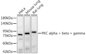 PKC alpha + beta + gamma Rabbit mAb
