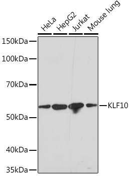 KLF10 Rabbit mAb