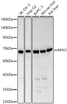 RPN1 Rabbit pAb