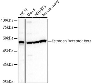 Estrogen Receptor beta Rabbit pAb