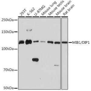 MIB1/DIP1 Rabbit mAb