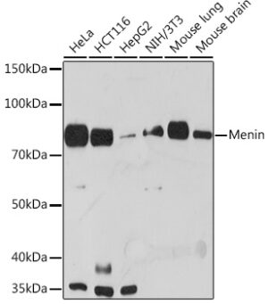 Menin Rabbit mAb