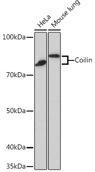 Coilin Rabbit mAb