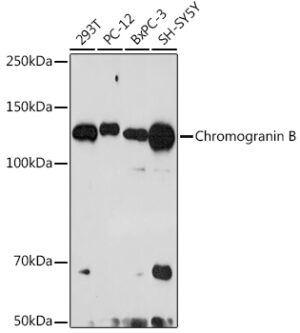 Chromogranin B Rabbit mAb