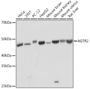 AGTR2 Rabbit mAb