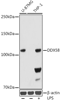 Rig-I/DDX58 Rabbit mAb