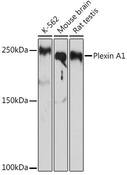 Plexin A1 Rabbit mAb