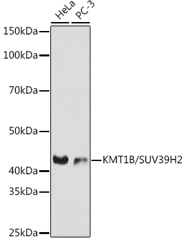 KMT1B / SUV39H2 Rabbit mAb