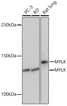 MYLK Rabbit mAb