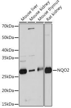 NQO2 Rabbit mAb