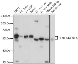 FKBP51/FKBP5 Rabbit pAb