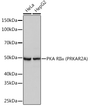 PKA RIIα (PRKAR2A) Rabbit mAb