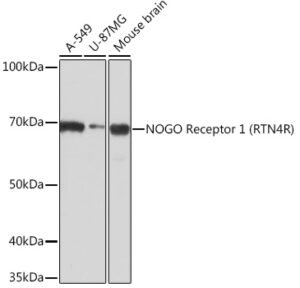 NOGO Receptor 1 (RTN4R) Rabbit mAb