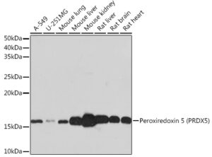 Peroxiredoxin 5 (PRDX5) Rabbit mAb