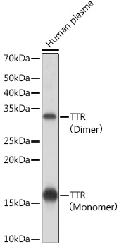 TTR Rabbit mAb