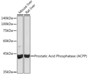 Prostatic Acid Phosphatase (ACPP) Rabbit mAb