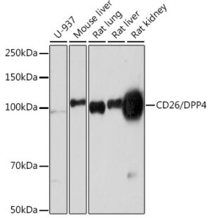 CD26/DPP4 Rabbit mAb