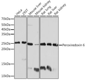 Peroxiredoxin 6 Rabbit mAb
