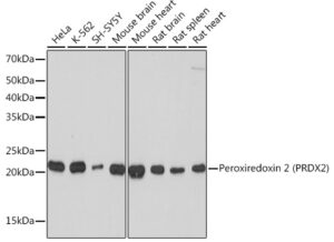 Peroxiredoxin 2 (PRDX2) Rabbit mAb