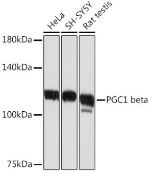 PGC1 beta Rabbit mAb